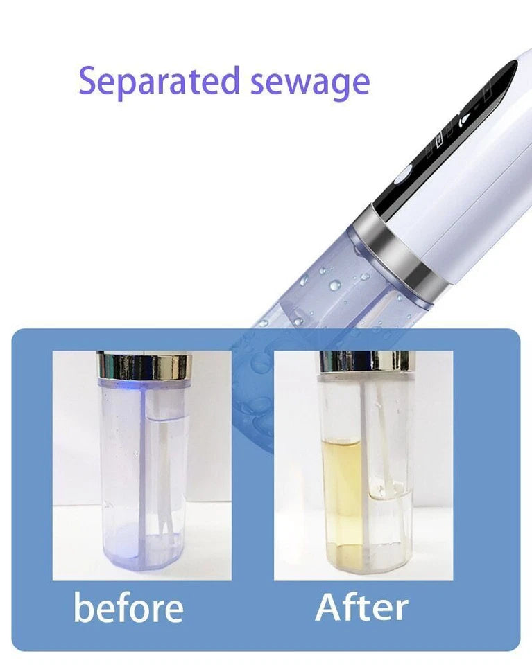 Bubble Facial & Blackhead Remover – Deep Pore Cleanser for Acne, Oil Control & Glowing Skin | Bubble Technology