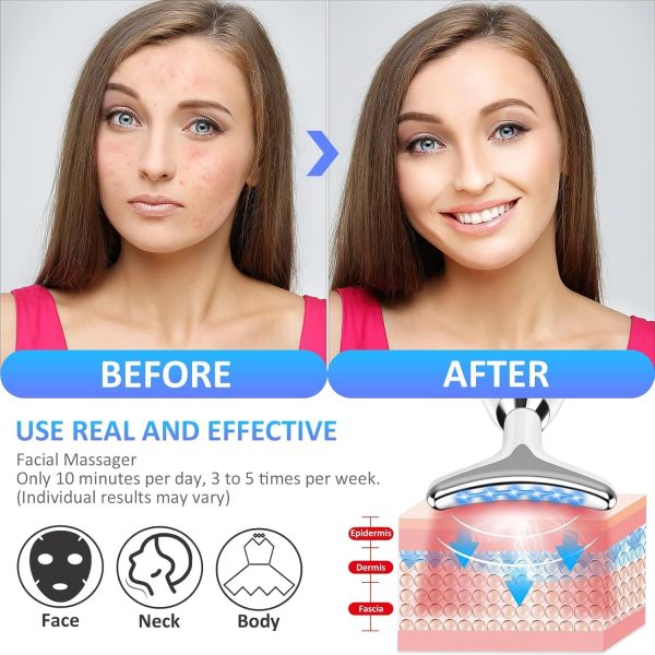 ES-1081 IPL Face Massager – Anti-Aging & Wrinkle Reducing Device | Reduces Puffiness, Fine Lines & Wrinkles